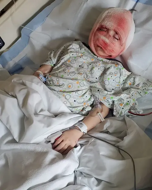 Bernardo apos o acidente