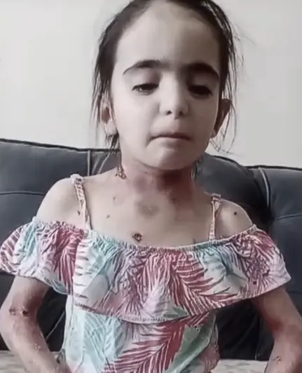 Laura cercada de cuidado e acompanhamento